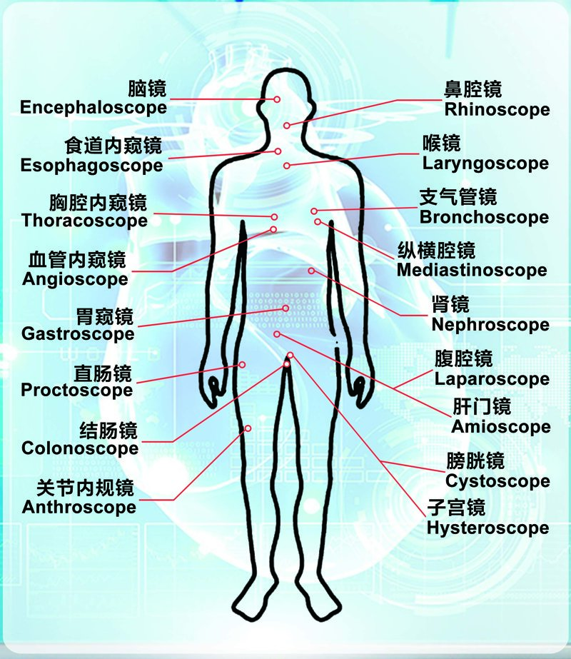 内窥镜的类型