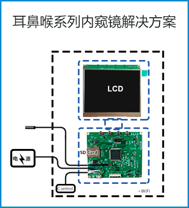 耳喉鼻系列内窥镜解决方案